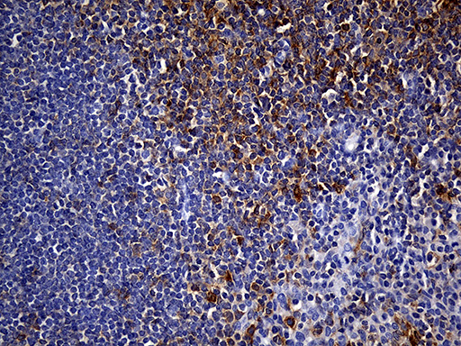 CYTH4 / PSCD4 Antibody - Immunohistochemical staining of paraffin-embedded Human tonsil within the normal limits using anti-CYTH4 mouse monoclonal antibody. (Heat-induced epitope retrieval by 1mM EDTA in 10mM Tris buffer. (pH8.5) at 120°C for 3 min. (1:150)