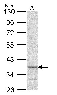 CYTIP Antibody - Sample (30 ug of whole cell lysate). A: A549. 10% SDS PAGE. CYTIP antibody diluted at 1:1000.