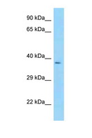 CYTIP Antibody - CYTIP antibody Western blot of Fetal Heart lysate. Antibody concentration 1 ug/ml.  This image was taken for the unconjugated form of this product. Other forms have not been tested.