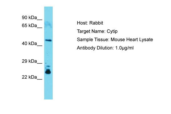 CYTIP Antibody -  This image was taken for the unconjugated form of this product. Other forms have not been tested.