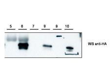 CYTIP Antibody - Anti-Cybr Antibody - Western Blot. Western blot of anti-Cybr antibody shows detection of recombinant Cybr using anti-HA tag antibody after immunoprecipitation using anti-Cybr. Lane 5 contains lysate from control HEK293 cells. Lane 6 shows IP/WB of HEK293 cells expressing Cybr-HA. Lane 7 and 8 are loaded similarly to lanes 5 and 6 but were immunoprecipitated with anti-HA. Lane 9 contains marker. Lane 10 contains purified CybrHA. Personal Communication, V. Coppola, NCI, Bethesda, MD.