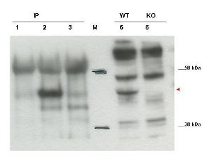 CYTIP Antibody - Anti-Cybr Antibody - Western Blot. Western blot of affinity purified anti-Cybr antibody shows detection of endogenous Cybr from mouse splenocytes using anti-Cybr antibody to immunoprecipitate and western blot (lanes 1-3). Lane 1 shows reactivity of pre-immune sera. Lane 2 shows endogenous Cybr detected with antibody. Lane 3 shows no band detected in lysates prepared from splenocytes of Cybr knock-out mouse. Lane 5 shows direct Western blot of wt splenocytes. Lane 6 shows direct Western blot of knock out mouse. Personal Communication, V. Coppola, NCI, Bethesda, MD.