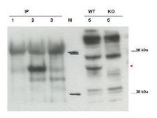 CYTIP Antibody - Western blot using the affinity purified anti-Cybr antibody shows detection of endogenous Cybr from mouse splenocytes using anti-Cybr antibody to immunoprecipitate and western blot (lanes 1-3). Lane 1 shows reactivity of pre-immune sera. Lane 2 shows endogenous Cybr detected with antibody. Lane 3 shows no band detected in lysates prepared from splenocytes of Cybr knock-out mouse. Lane 5 shows direct western blot of wt splenocytes. Lane 6 shows direct western blot of knock out mouse.