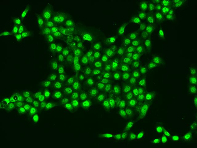 CYTIP Antibody - Immunofluorescence staining of CYTIP in A431 cells. Cells were fixed with 4% PFA, permeabilzed with 0.1% Triton X-100 in PBS, blocked with 10% serum, and incubated with rabbit anti-Human CYTIP polyclonal antibody (dilution ratio 1:200) at 4°C overnight. Then cells were stained with the Alexa Fluor 488-conjugated Goat Anti-rabbit IgG secondary antibody (green). Positive staining was localized to Nucleus.