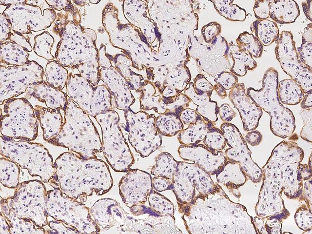 CYTIP Antibody - Immunochemical staining of human CYTIP in human placenta with rabbit polyclonal antibody at 1:100 dilution, formalin-fixed paraffin embedded sections.