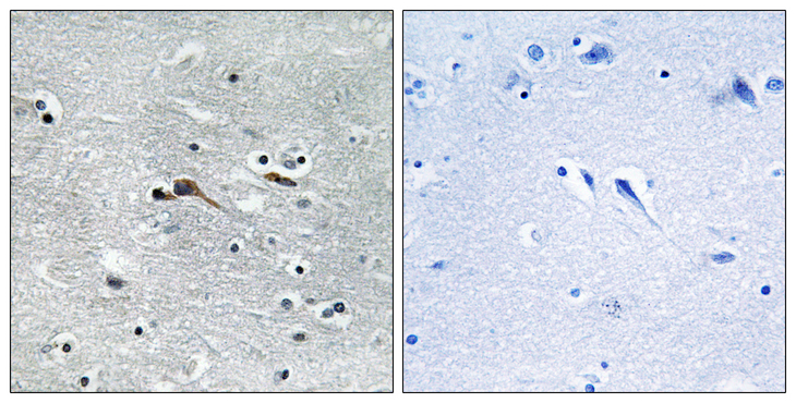 CYTL1 / C17 Antibody - Immunohistochemistry analysis of paraffin-embedded human brain tissue, using CYTL1 Antibody. The picture on the right is blocked with the synthesized peptide.