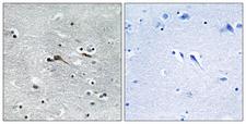 CYTL1 / C17 Antibody - Immunohistochemistry analysis of paraffin-embedded human brain tissue, using CYTL1 Antibody. The picture on the right is blocked with the synthesized peptide.
