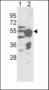 Cytochrome P450 2R1 / CYP2R1 Antibody - Western blot of CYP2R1 Antibody in NCI-H460 cell line(lane 1) and mouse liver tissue(lane 2) lysates (35 ug/lane). CYP2R1 (arrow) was detected using the purified antibody.