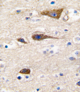 Cytochrome P450 2R1 / CYP2R1 Antibody - Formalin-fixed and paraffin-embedded human brain tissue reacted with CYP2R1 antibody , which was peroxidase-conjugated to the secondary antibody, followed by DAB staining. This data demonstrates the use of this antibody for immunohistochemistry; clinical relevance has not been evaluated.