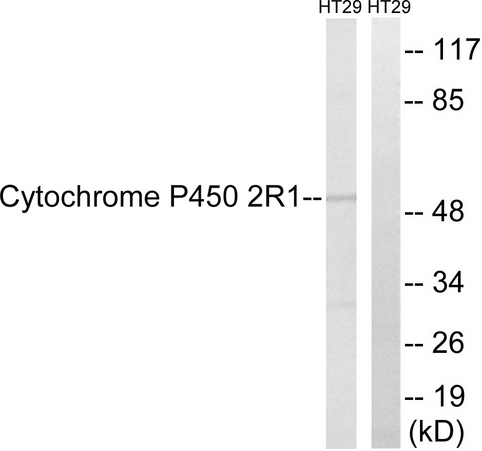 Cytochrome P450 2R1 / CYP2R1 Antibody - Western blot analysis of lysates from HT29 cells, using Cytochrome P450 2R1 Antibody. The lane on the right is blocked with the synthesized peptide.