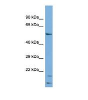 Cytochrome P450 2R1 / CYP2R1 Antibody - Western blot of Human COLO205. CYP2R1 antibody dilution 1.0 ug/ml.  This image was taken for the unconjugated form of this product. Other forms have not been tested.