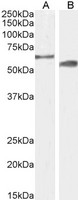 Cytochrome P450 2R1 / CYP2R1 Antibody - Antibody (2µg/ml) staining of Mouse (A) and Rat (B) Testes lysate (35µg protein in RIPA buffer). Detected by chemiluminescence.