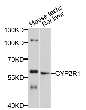 Cytochrome P450 2R1 / CYP2R1 Antibody - Western blot analysis of extracts of various cell lines, using CYP2R1 antibody at 1:1000 dilution. The secondary antibody used was an HRP Goat Anti-Rabbit IgG (H+L) at 1:10000 dilution. Lysates were loaded 25ug per lane and 3% nonfat dry milk in TBST was used for blocking. An ECL Kit was used for detection and the exposure time was 15s.