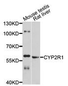 Cytochrome P450 2R1 / CYP2R1 Antibody - Western blot analysis of extracts of various cell lines, using CYP2R1 antibody at 1:1000 dilution. The secondary antibody used was an HRP Goat Anti-Rabbit IgG (H+L) at 1:10000 dilution. Lysates were loaded 25ug per lane and 3% nonfat dry milk in TBST was used for blocking. An ECL Kit was used for detection and the exposure time was 15s.