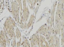 Cytochrome P450 2R1 / CYP2R1 Antibody - 1:100 staining mouse muscle tissue by IHC-P. The sample was formaldehyde fixed and a heat mediated antigen retrieval step in citrate buffer was performed. The sample was then blocked and incubated with the antibody for 1.5 hours at 22°C. An HRP conjugated goat anti-rabbit antibody was used as the secondary.