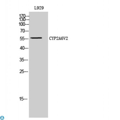 Cytochrome P450 Antibody - Western Blot (WB) analysis of L929 cells using CYP2A6V2 polyclonal antibody.