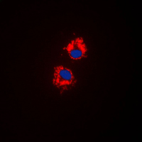 Cytochrome P450 CYP1A1/2 Antibody - Immunofluorescent analysis of Cytochrome P450 1A1/2 staining in HeLa cells. Formalin-fixed cells were permeabilized with 0.1% Triton X-100 in TBS for 5-10 minutes and blocked with 3% BSA-PBS for 30 minutes at room temperature. Cells were probed with the primary antibody in 3% BSA-PBS and incubated overnight at 4 C in a humidified chamber. Cells were washed with PBST and incubated with a DyLight 594-conjugated secondary antibody (red) in PBS at room temperature in the dark. DAPI was used to stain the cell nuclei (blue).