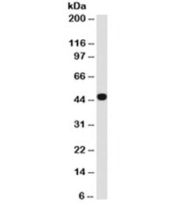 Cytokeratin 1+8 Antibody - Western blot testing of A431 cell lysate with Keratin 18 antibody (clone C-04). This image was taken for the unmodified form of this product. Other forms have not been tested.