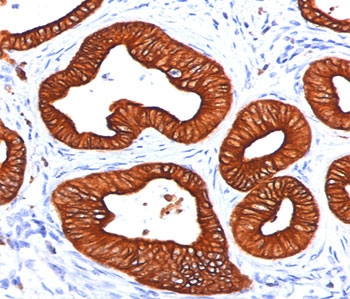 Cytokeratin 1+8 Antibody - Cytokeratin 18 antibody DC10 immunohistochemistry sweat gland.  This image was taken for the unmodified form of this product. Other forms have not been tested.