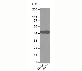 Cytokeratin 1+8 Antibody - Cytokeratin 18 antibody DC10 western blot.  This image was taken for the unmodified form of this product. Other forms have not been tested.