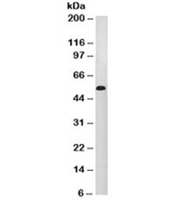 Cytokeratin 10+13 Antibody - Western blot testing of A431 cell lysate and Cytokeratin 10 + 13 antibody (clone DE-K13). This image was taken for the unmodified form of this product. Other forms have not been tested.
