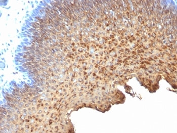 Cytokeratin 10+13 Antibody - Formalin-fixed, paraffin-embedded human tonsil stained with Cytokeratin 10 + 13 antibody (SPM262).  This image was taken for the unmodified form of this product. Other forms have not been tested.