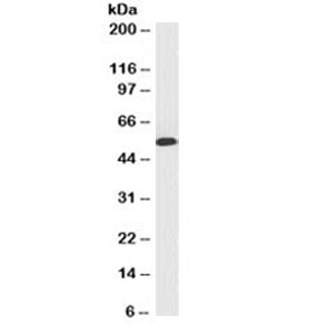 Cytokeratin 10+13 Antibody - Western blot testing of A431 cell lysate and Cytokeratin 10 + 13 antibody (clone SPM262). This image was taken for the unmodified form of this product. Other forms have not been tested.