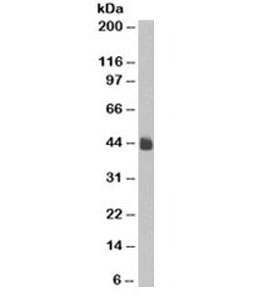 Cytokeratin 5+8 Antibody - Western blot testing of HeLa cell lysate and Cytokeratin 5 + 8 antibody (clone C-50). Predicted molecular weight: 52-58kDa but observed here at ~43kDa.