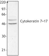 Cytokeratin 7+17 Antibody - Hela cell extract was resolved by electrophoresis, transferred to nitrocellulose and probed with monoclonal anti-cytokeratin 7 + 17 antibody (clone C-46).