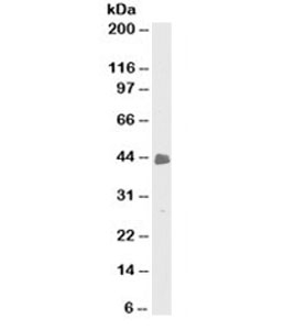 Cytokeratin 8+18 Antibody - Western blot testing of HeLa cell lysate with Cytokeratin 8 + 18 antibody (clone C-51). Predicted molecular weight: ~53/48kDa (CK8/CK18), observed here at ~43kDa. This image was taken for the unmodified form of this product. Other forms have not been tested.