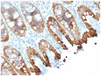 Cytokeratin 8+18 Antibody - IHC staining of FFPE human colon tissue with recombinant Cytokeratin 8/18 antibody (clone rKRT8.18/1346). Required HIER: boil tissue sections in 10mM citrate buffer, pH 6, for 10-20 min and allow to cool before testing.