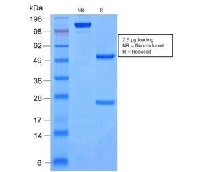 Cytokeratin 8+18 Antibody - SDS-PAGE analysis of purified, BSA-free recombinant Cytokeratin 8/18 antibody (clone rKRT8.18/1346) as confirmation of integrity and purity.