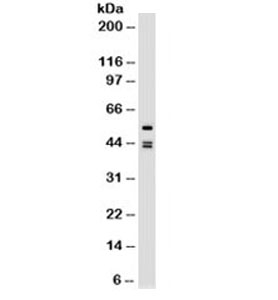 Cytokeratin 8+18 Antibody - Western blot testing of HeLa cell lysate with Cytokeratin 8 + 18 antibody (clone SPM141). This image was taken for the unmodified form of this product. Other forms have not been tested.