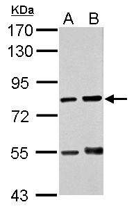 Cytokine IK Antibody - Sample (30 ug of whole cell lysate). A: THP-1, B: HL-60. 7.5% SDS PAGE. Cytokine IK antibody diluted at 1:1000.