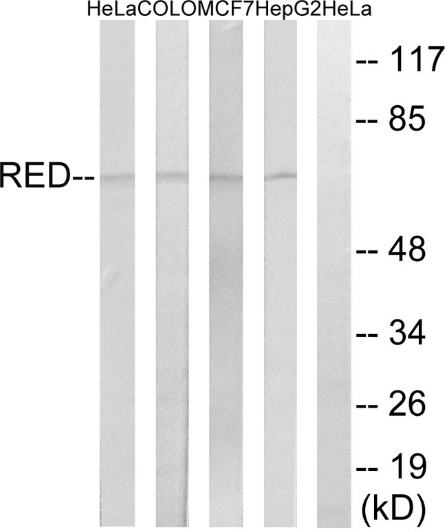 Cytokine IK Antibody - Western blot analysis of lysates from HepG2, MCF-7, COLO, and HeLa cells, using RED Antibody. The lane on the right is blocked with the synthesized peptide.
