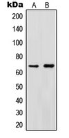 Cytokine IK Antibody - Western blot analysis of Cytokine IK expression in HeLa (A); HEK293T (B) whole cell lysates.
