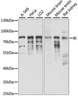 Cytokine IK Antibody - Western blot analysis of extracts of various cell lines, using IK antibody at 1:1000 dilution. The secondary antibody used was an HRP Goat Anti-Rabbit IgG (H+L) at 1:10000 dilution. Lysates were loaded 25ug per lane and 3% nonfat dry milk in TBST was used for blocking. An ECL Kit was used for detection and the exposure time was 15S.