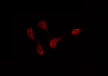 Cytokine IK Antibody - Staining HeLa cells by IF/ICC. The samples were fixed with PFA and permeabilized in 0.1% Triton X-100, then blocked in 10% serum for 45 min at 25°C. The primary antibody was diluted at 1:200 and incubated with the sample for 1 hour at 37°C. An Alexa Fluor 594 conjugated goat anti-rabbit IgG (H+L) Ab, diluted at 1/600, was used as the secondary antibody.