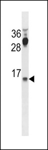 CYYR1 Antibody - CYYR1 Antibody western blot of HepG2 cell line lysates (35 ug/lane). The CYYR1 antibody detected the CYYR1 protein (arrow).