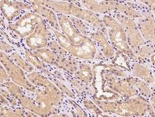 CYYR1 Antibody - Immunochemical staining of human CYYR1 in human kidney with rabbit polyclonal antibody at 1:200 dilution, formalin-fixed paraffin embedded sections.