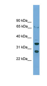 D-Binding Protein / DBP Antibody - DBP antibody Western blot of HepG2 cell lysate. This image was taken for the unconjugated form of this product. Other forms have not been tested.