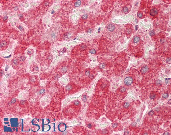 D-Binding Protein / DBP Antibody - Human Liver: Formalin-Fixed, Paraffin-Embedded (FFPE).  This image was taken for the unconjugated form of this product. Other forms have not been tested.