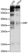 D-Binding Protein / DBP Antibody - Western blot analysis of extracts of various cell lines, using DBP antibody at 1:1000 dilution. The secondary antibody used was an HRP Goat Anti-Rabbit IgG (H+L) at 1:10000 dilution. Lysates were loaded 25ug per lane and 3% nonfat dry milk in TBST was used for blocking. An ECL Kit was used for detection and the exposure time was 15S.