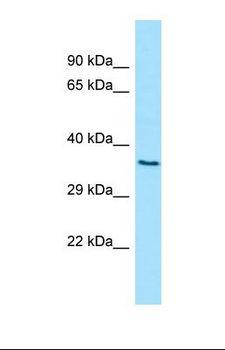 D2HGDH Antibody - Western blot of Human 293T. D2HGDH antibody dilution 1.0 ug/ml.  This image was taken for the unconjugated form of this product. Other forms have not been tested.