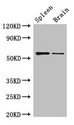 D2HGDH Antibody - Western Blot Positive WB detected in: Mouse spleen tissue, Mouse brain tissue All lanes: D2HGDH antibody at 3µg/ml Secondary Goat polyclonal to rabbit IgG at 1/50000 dilution Predicted band size: 57, 33, 35 kDa Observed band size: 57 kDa