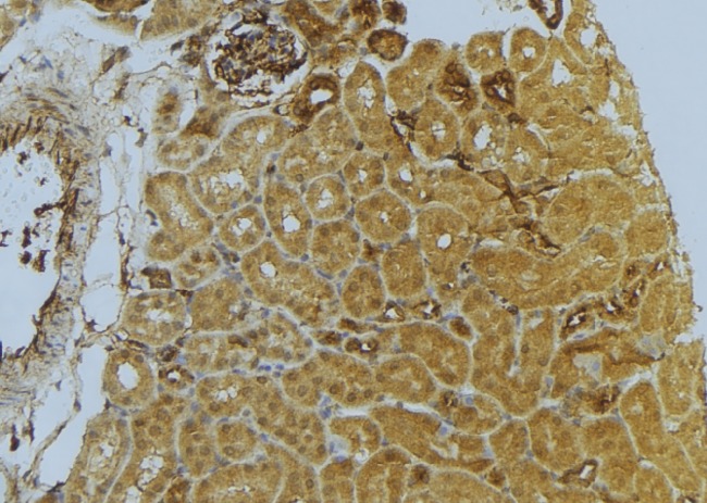 D2HGDH Antibody - 1:100 staining mouse kidney tissue by IHC-P. The sample was formaldehyde fixed and a heat mediated antigen retrieval step in citrate buffer was performed. The sample was then blocked and incubated with the antibody for 1.5 hours at 22°C. An HRP conjugated goat anti-rabbit antibody was used as the secondary.