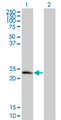 D52 / TPD52 Antibody - Western Blot analysis of TPD52 expression in transfected 293T cell line by TPD52 monoclonal antibody (M01), clone 1B6.Lane 1: TPD52 transfected lysate(19.863 KDa).Lane 2: Non-transfected lysate.