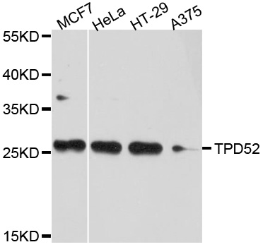 D52 / TPD52 Antibody - Western blot analysis of extracts of various cell lines, using TPD52 antibody at 1:1000 dilution. The secondary antibody used was an HRP Goat Anti-Rabbit IgG (H+L) at 1:10000 dilution. Lysates were loaded 25ug per lane and 3% nonfat dry milk in TBST was used for blocking. An ECL Kit was used for detection and the exposure time was 10s.