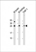 D52 / TPD52 Antibody - All lanes: Anti-TPD52 Antibody (N-Term) at 1:2000 dilution Lane 1: mouse brain lysate Lane 2: mouse kidney lysate Lane 3: THP-1 whole cell lysate Lysates/proteins at 20 µg per lane. Secondary Goat Anti-Rabbit IgG, (H+L), Peroxidase conjugated at 1/10000 dilution. Predicted band size: 24 kDa Blocking/Dilution buffer: 5% NFDM/TBST.