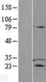 D52 / TPD52 Protein - Western validation with an anti-DDK antibody * L: Control HEK293 lysate R: Over-expression lysate